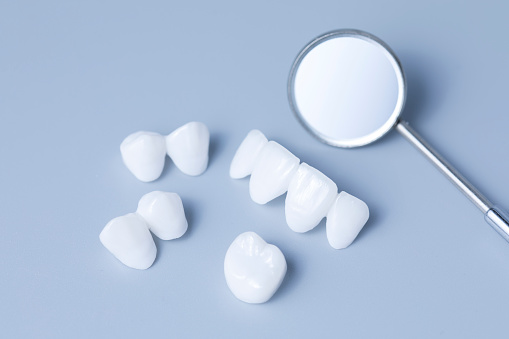 Dental Implants Sebastopol