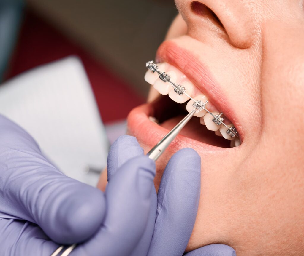 The Top 5 Cosmetic Dentistry Procedures image 3